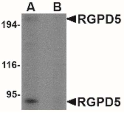 Western Blot: RGPD5 AntibodyBSA Free [NBP2-41084]