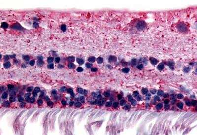 Immunohistochemistry-Paraffin: RGR Antibody - BSA Free [NBP3-06674]