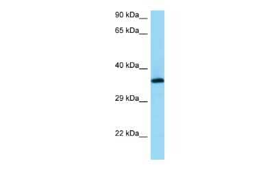 Western Blot: RGR Antibody [NBP2-84244]