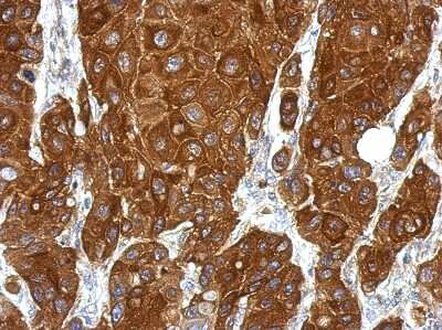 Immunohistochemistry-Paraffin: RGS1 Antibody [NBP2-20146]