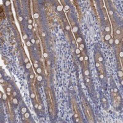 Immunohistochemistry-Paraffin: RGS1 Antibody [NBP3-17666]