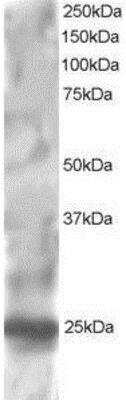 Western Blot: RGS1 Antibody [NB100-1029]