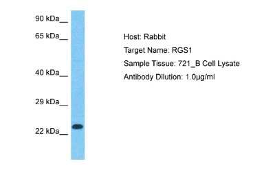 Western Blot: RGS1 Antibody [NBP2-82338]