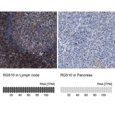 Immunohistochemistry-Paraffin: RGS10 Antibody [NBP1-86020]