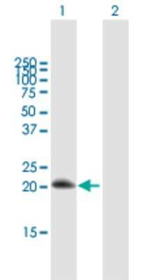 Western Blot: RGS10 Antibody [H00006001-B01P]