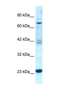 Western Blot: RGS10 Antibody [NBP1-55396]