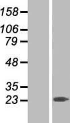 Western Blot: RGS10 Overexpression Lysate [NBP2-08056]