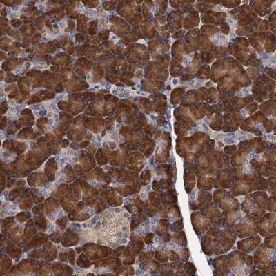 Immunohistochemistry: RGS11 Antibody [NBP2-48745]