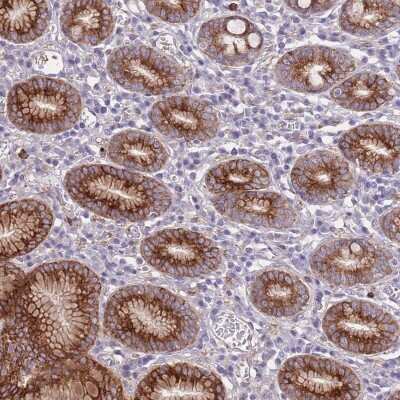 Immunohistochemistry: RGS11 Antibody [NBP2-48781]