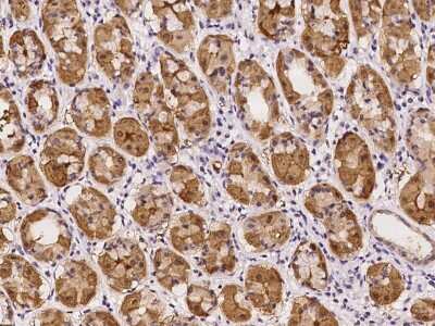 Immunohistochemistry-Paraffin: RGS11 Antibody [NBP2-97203]