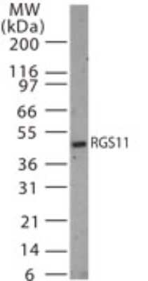 Western Blot: RGS11 Antibody [NB100-56658]