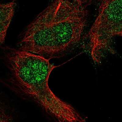 Immunocytochemistry/ Immunofluorescence: RGS12 Antibody [NBP2-55755]