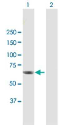 Western Blot: RGS12 Antibody [H00006002-B01P]