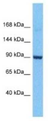 Western Blot: RGS12 Antibody [NBP3-09983]