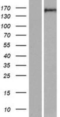 Western Blot: RGS12 Overexpression Lysate [NBP2-04708]