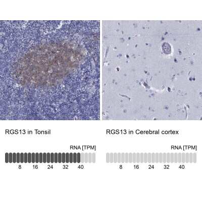 Immunocytochemistry/ Immunofluorescence: RGS13 Antibody [NBP3-17112]