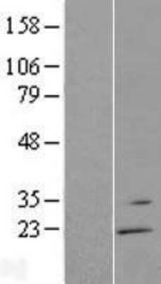 Western Blot: RGS13 Overexpression Lysate [NBP2-09788]