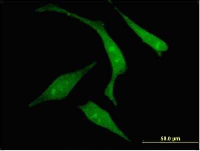 Immunocytochemistry/ Immunofluorescence: RGS14 Antibody (2F8) [H00010636-M03]