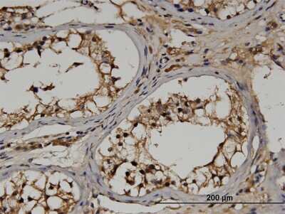 Immunohistochemistry-Paraffin: RGS14 Antibody (2F8) [H00010636-M03]