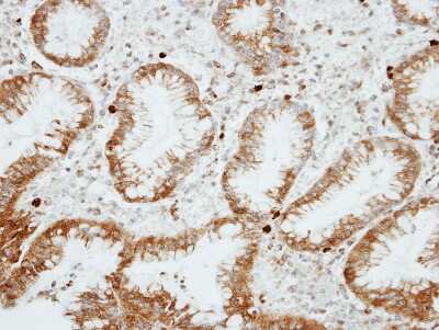 Immunohistochemistry-Paraffin: RGS14 Antibody [NBP1-31174]