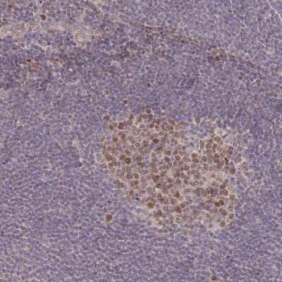 Immunohistochemistry-Paraffin: RGS14 Antibody [NBP2-13227]