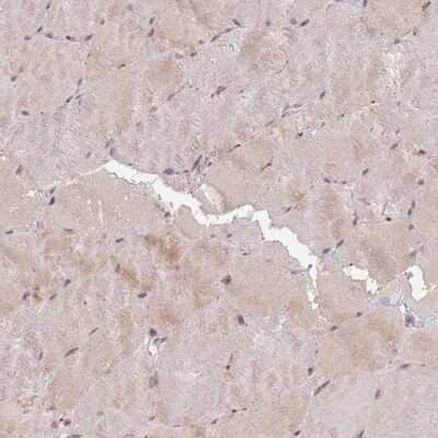 Immunohistochemistry-Paraffin: RGS14 Antibody [NBP2-13227]