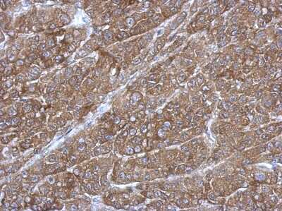 Immunohistochemistry-Paraffin: RGS14 Antibody [NBP2-20148]