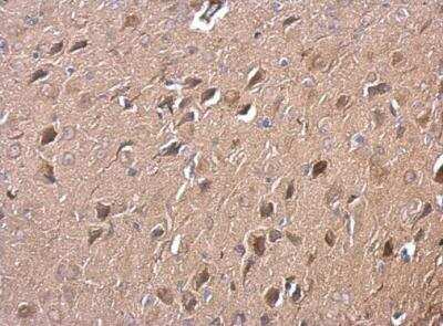 Immunohistochemistry-Paraffin: RGS14 Antibody [NBP2-20148]
