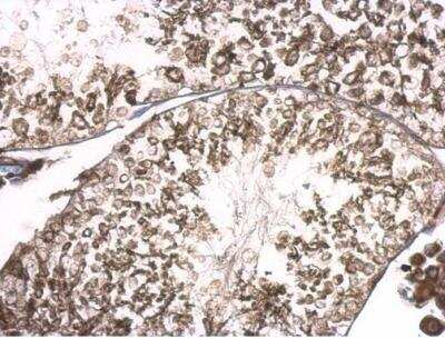 Immunohistochemistry-Paraffin: RGS14 Antibody [NBP2-20148]