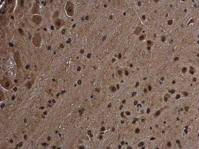 Immunohistochemistry-Paraffin: RGS14 Antibody [NBP3-12912]