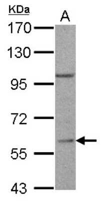 Western Blot: RGS14 Antibody [NBP1-31174]