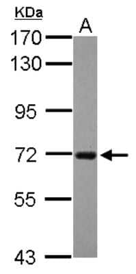 Western Blot: RGS14 Antibody [NBP2-20147]