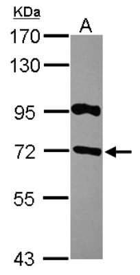 Western Blot: RGS14 Antibody [NBP2-20148]