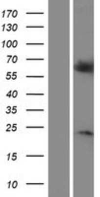 Western Blot: RGS14 Overexpression Lysate [NBP2-07614]