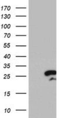 Western Blot: RGS16 Antibody (OTI4E5)Azide and BSA Free [NBP2-73881]