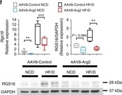 Western Blot: RGS16 Antibody (OTI4E5) [NBP2-01584]