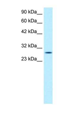 Western Blot: RGS16 Antibody [NBP1-55382]