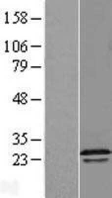 Western Blot: RGS16 Overexpression Lysate [NBL1-15322]