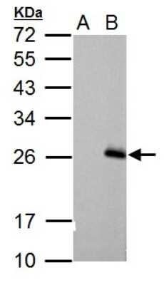 Western Blot: RGS17 Antibody [NBP1-33694]