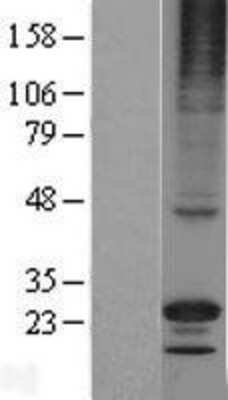 Western Blot: RGS17 Overexpression Lysate [NBL1-15323]