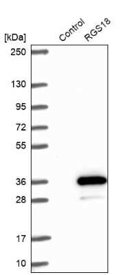 Western Blot: RGS18 Antibody [NBP1-92329]