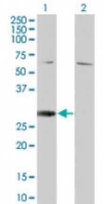 Western Blot: RGS18 Antibody [NBP2-24417]