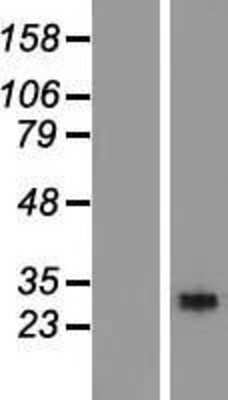 Western Blot: RGS18 Overexpression Lysate [NBL1-15324]