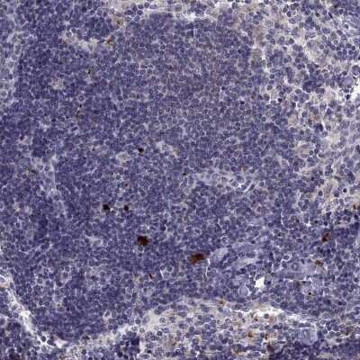 Immunohistochemistry-Paraffin: RGS19 Antibody [NBP2-62666]