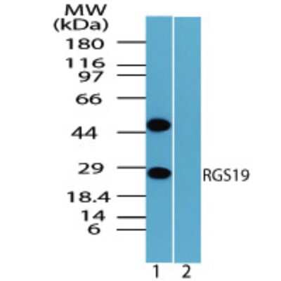 Western Blot: RGS19 Antibody [NBP2-24516]