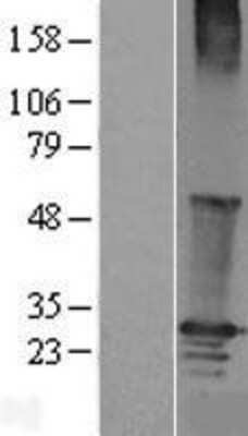 Western Blot: RGS19 Overexpression Lysate [NBL1-15325]