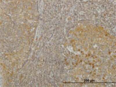 Immunohistochemistry-Paraffin: RGS2 Antibody (4C4) [H00005997-M01]