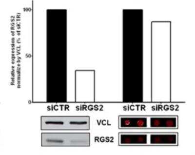 Knockdown Validated: RGS2 Antibody (4C4) [H00005997-M01]