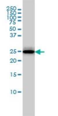 Western Blot: RGS2 Antibody (4C4) [H00005997-M01]