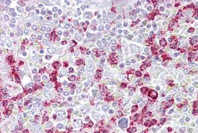 Immunohistochemistry: RGS2 Antibody [NBP3-10554]